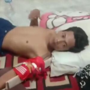 Supir Truk Dianiaya Olek OTK Hingga Patah Tulang